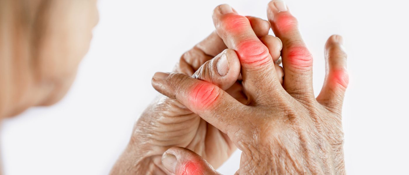 Supplements for Gout: Change Your Relationship with Gout for Good background image