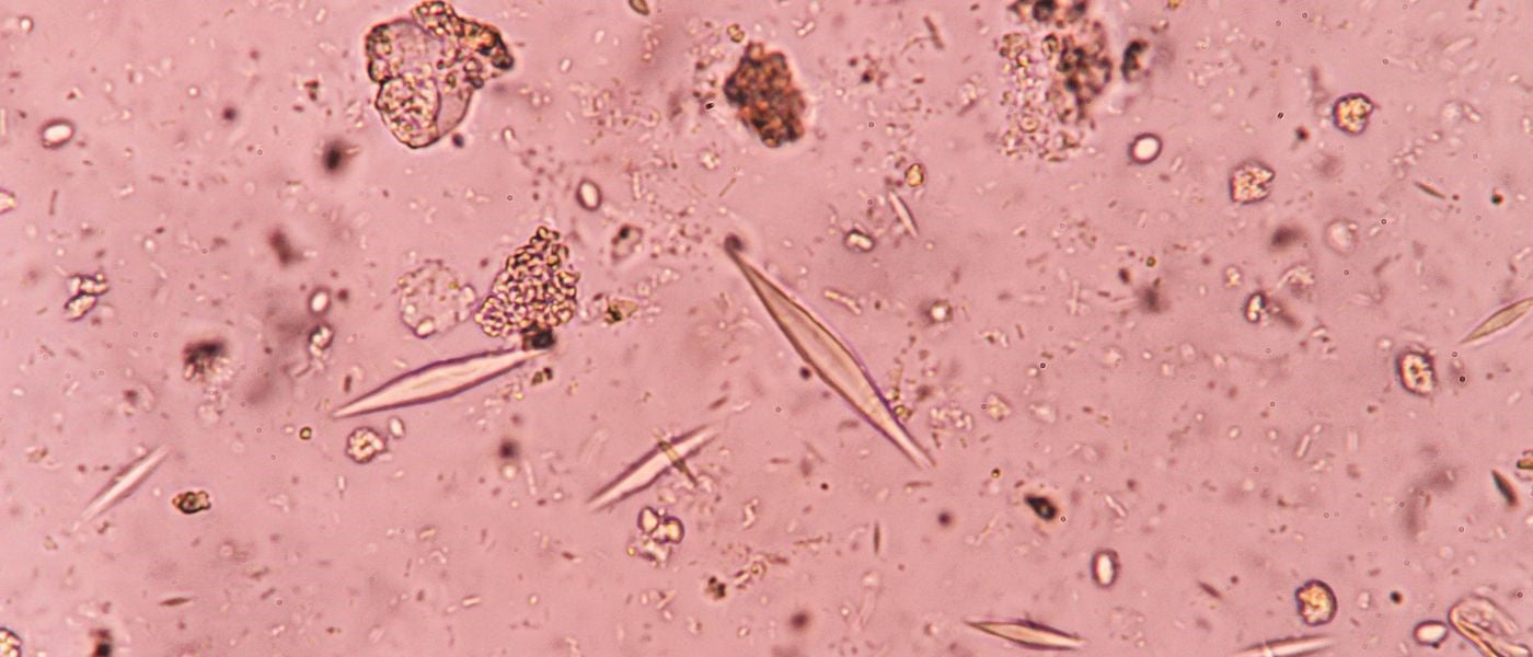 Gut Parasites: Types, Symptoms, and More background image