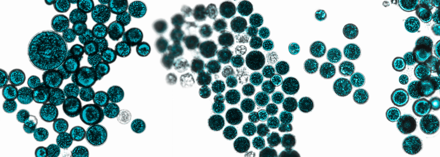 Introducing Postbiotics — The Newest Biotic for Total Microbiome Support background image