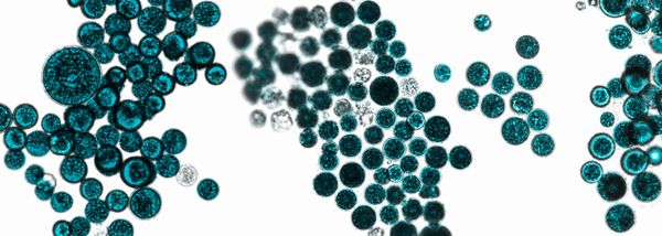 Introducing Postbiotics — The Newest Biotic for Total Microbiome Support